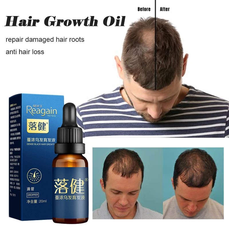 

Спрей Против выпадения волос, восстанавливающий поврежденные корни волос, тоник для женщин и мужчин, средство для Восстановления сухих вол...