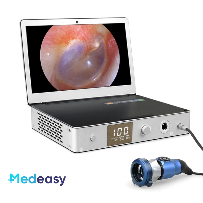 

3 In 1 Medical Full HD 1080P Endoscopy Endoscope Camera with LED Light Source Screen Monitor