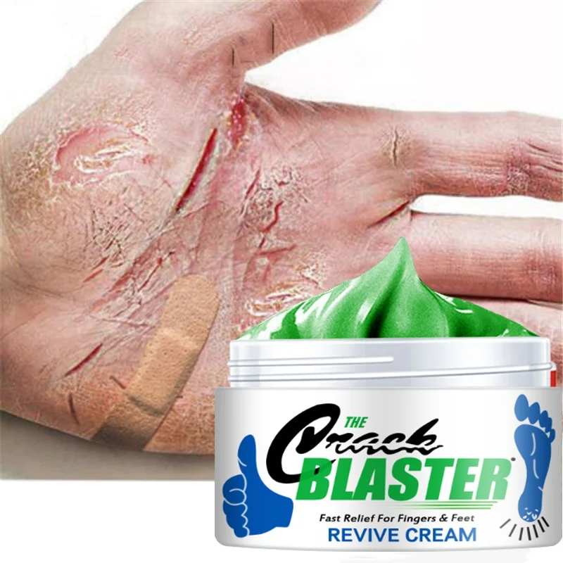 

15g/30g/50g hand and foot chapped repair cream skin moisturizing foot skin care