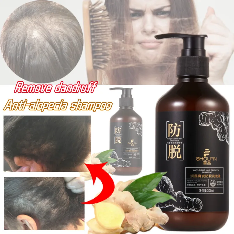 

Anti-stripping Shampoo Old Ginger Side Cypress Leaf Control Dandruff Antipruritic No Silicone Oil To Improve Head Itching 300ml