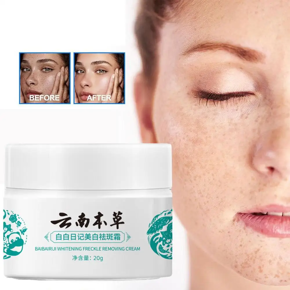 

Yunnan, травяное средство для эффективного удаления темных пятен, удаление кожи, осветление, увлажнение, уход, мелазма, крем для пятен Z7Q6