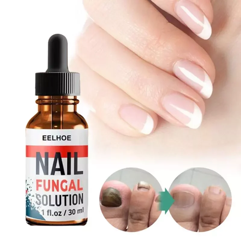 

2022NEW Fungal Nail Treatment Feet Care Essence To Anti Paronychia Remove Onychomycosis Care Repair Liquid TSLM1
