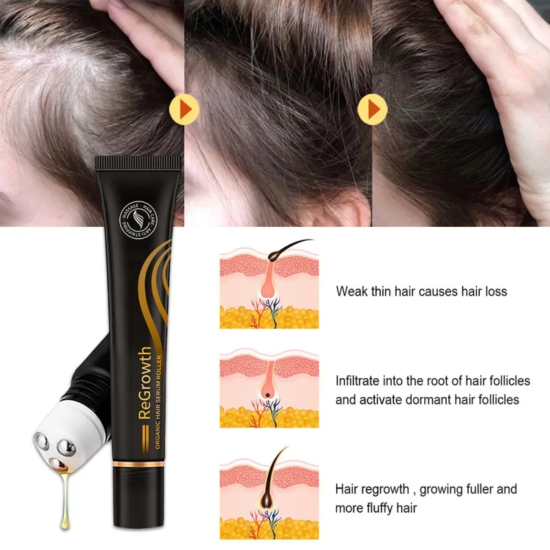 

Имбирное средство для лечения выпадения волос с эфирным маслом 20 мл, 7 дней, средство против выпадения с сильным корнем, сыворотка для волос