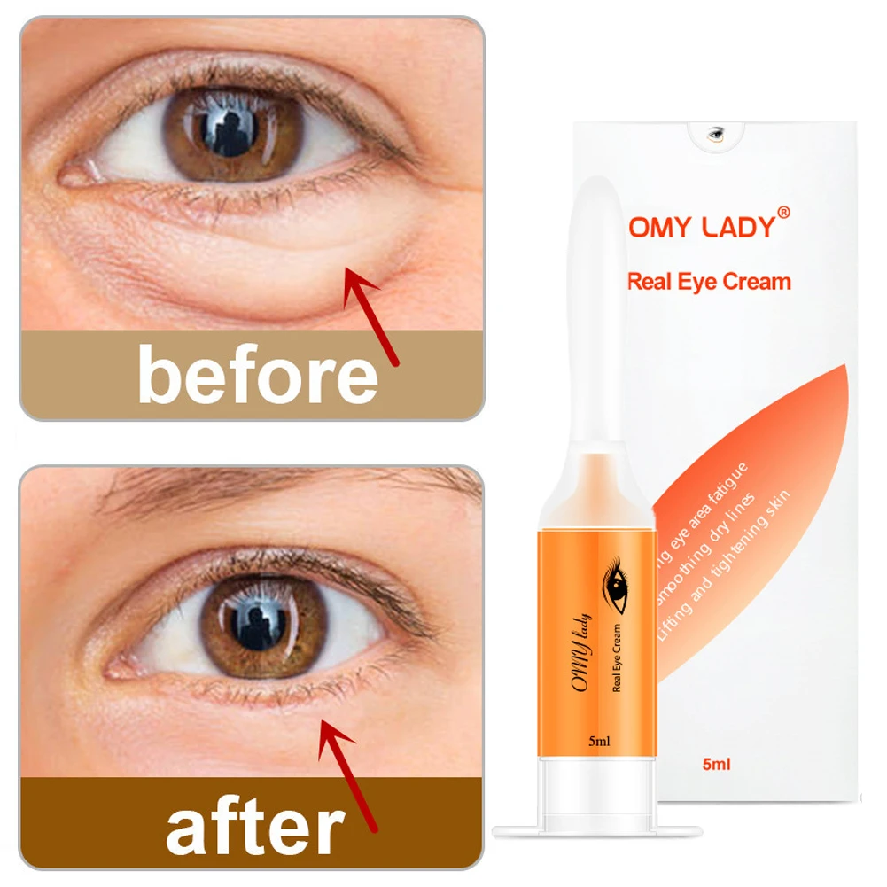 

Instant Remove Eyebags Eye Cream Firming Eye Anti Puffiness Fade Dark Circles Under Eye Anti Wrinkle Anti Aging Firmness Care 5g