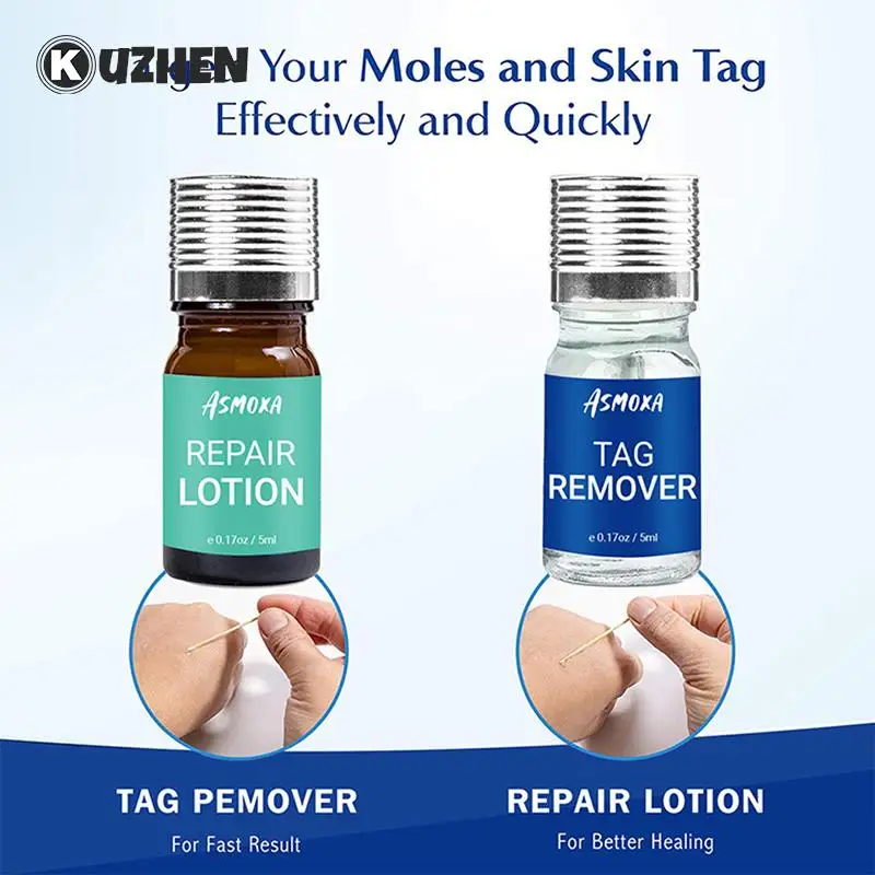 

Painless Dark Spot Remover Wart Removal Skin Tags Remover Cream Repair Serum Effective Face Skin Care Products