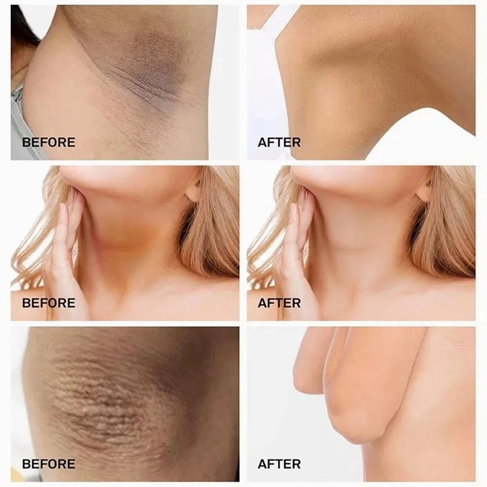 Отбеливающий крем FlowWeek для тела