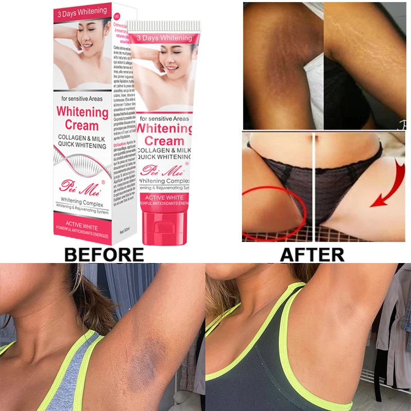 

Underarm Private Parts Whitening Cream Moisturizing Improve Arm Armpit Ankles Elbow Knee Body Dull Brighten Skin Care 50g