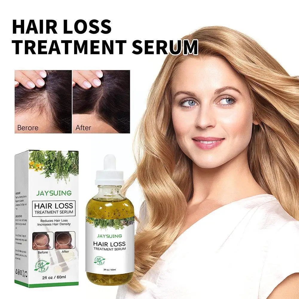 

60ml Hair Loss Treatment Shampoo Anti-itch Anti Dandruff Oil Control Serum Oil For Women Dry Damaged Bleached H E3Y2