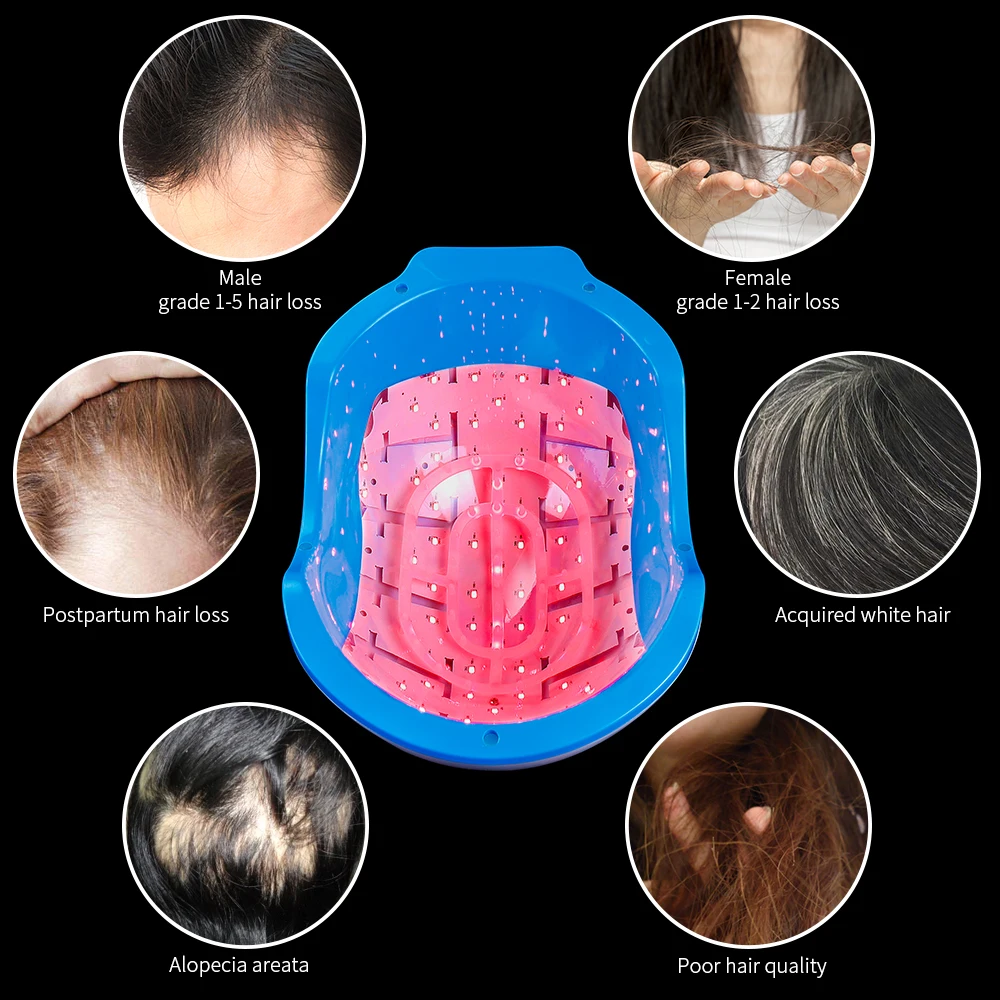 Hair Regrowth 678nm Laser Helmet 80Pcs Light Chips Laser Hair Growth Hat Anti Hair Loss Treatment Device Hair Restore Massager images - 6