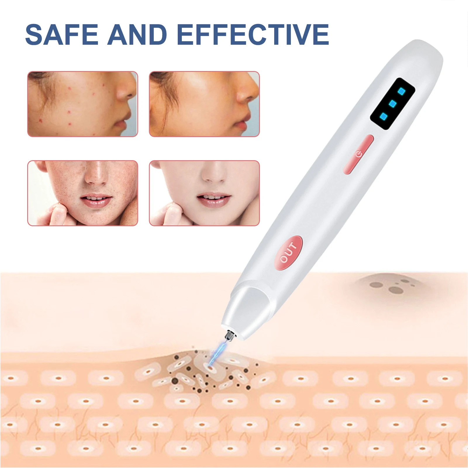 

Ручка для удаления этикеток кожи, перезаряжаемая ручка, инструменты для Удаления Лица с бытовым использованием, зарядка через USB, 10 сменных ...