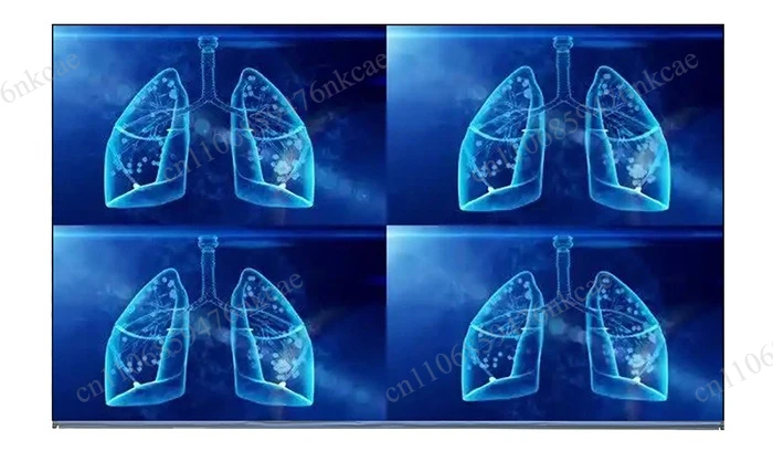 Фото LM238WR2-SPE1 23,8-дюймовый 4K 3840*2160 промышленный дисплей для микроскопов и медицинских изображений №5