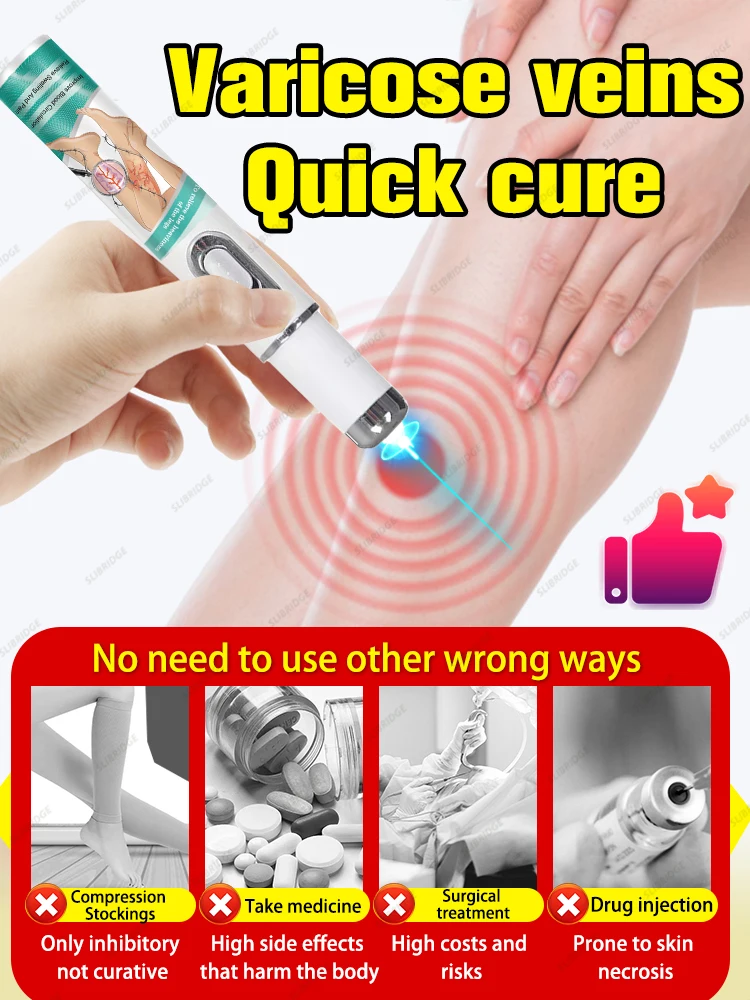 Крем-лазер Varicosse