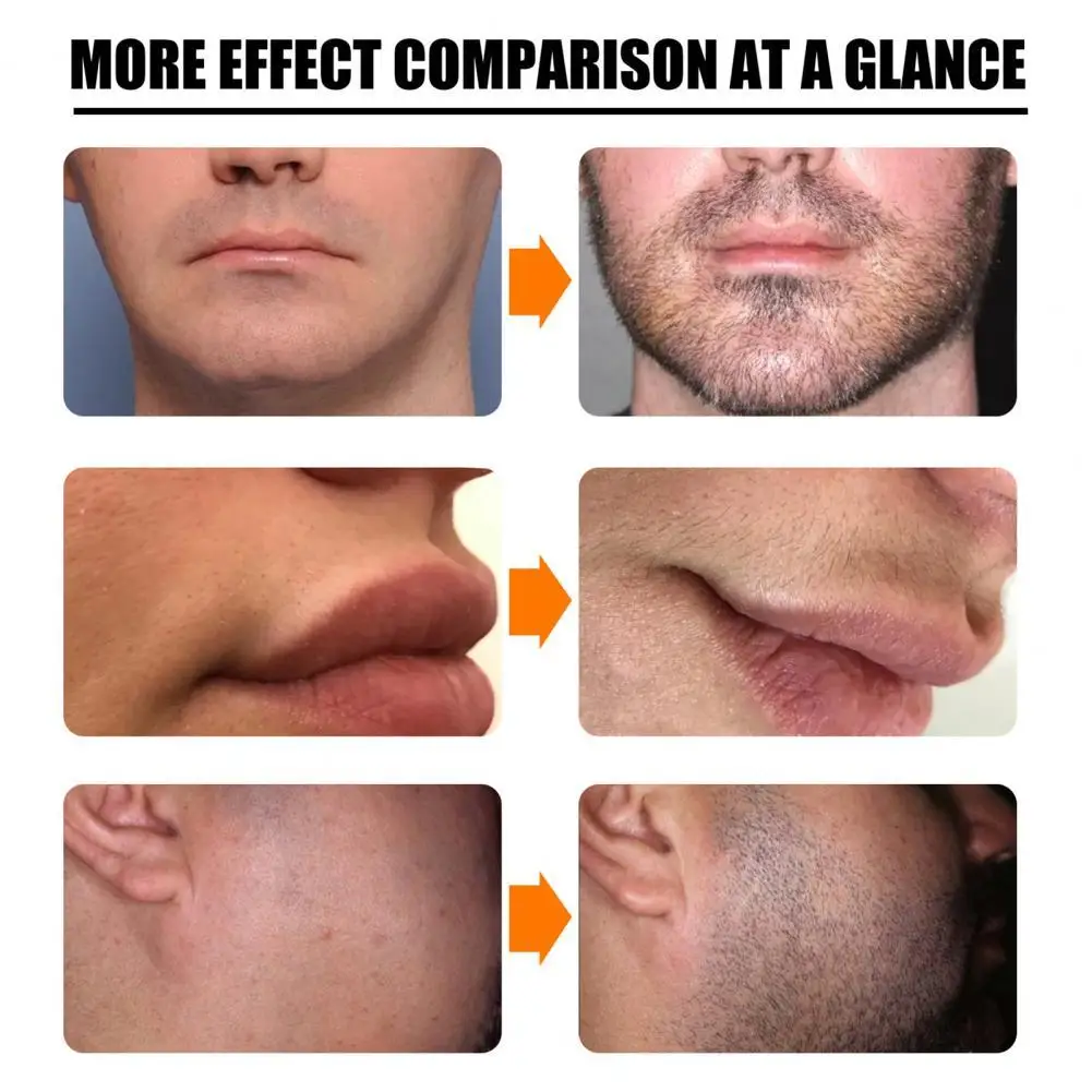 

30ml Durable Hair Growth Spray with Beard Roller Hair Growth Spray Treatment Spray Natural Extract