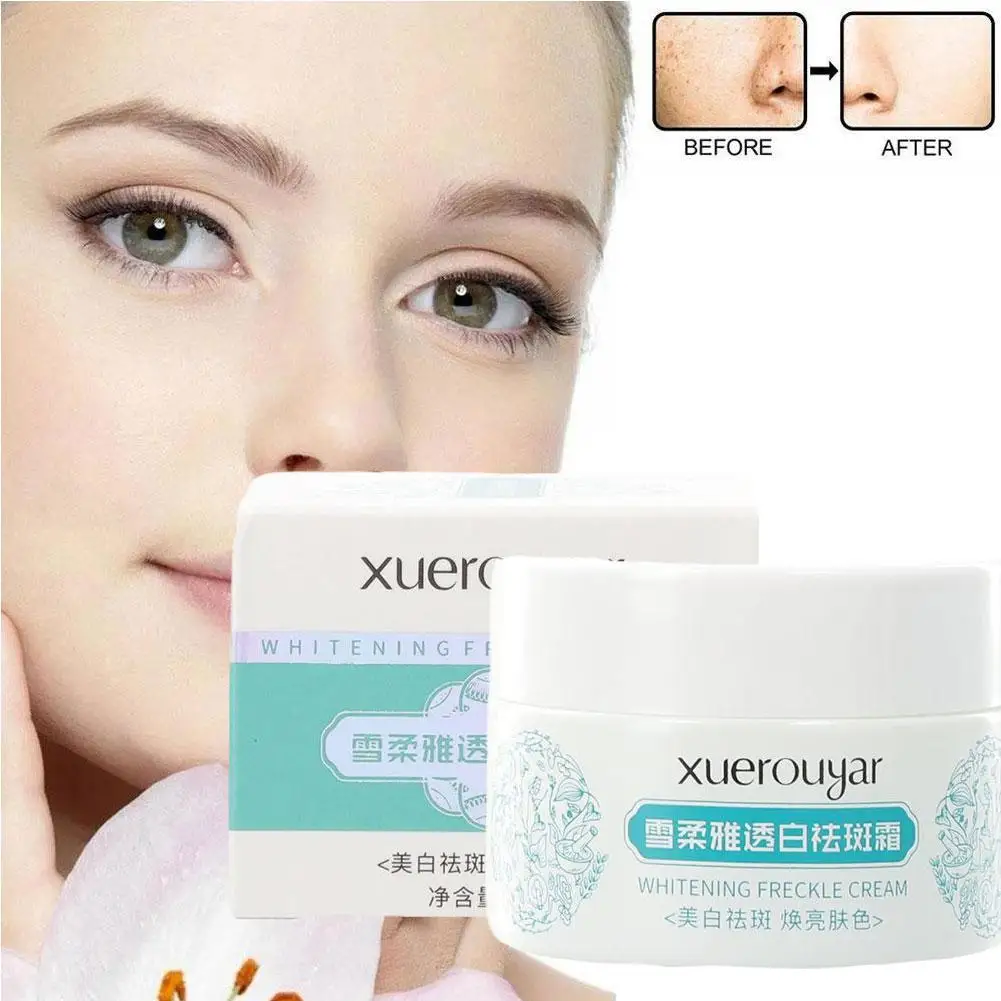 

30g White Spot Cream Fade Speckle Remove Freckle Acne Moisturizing Dark Spots Care Skin Face Beauty L8S4