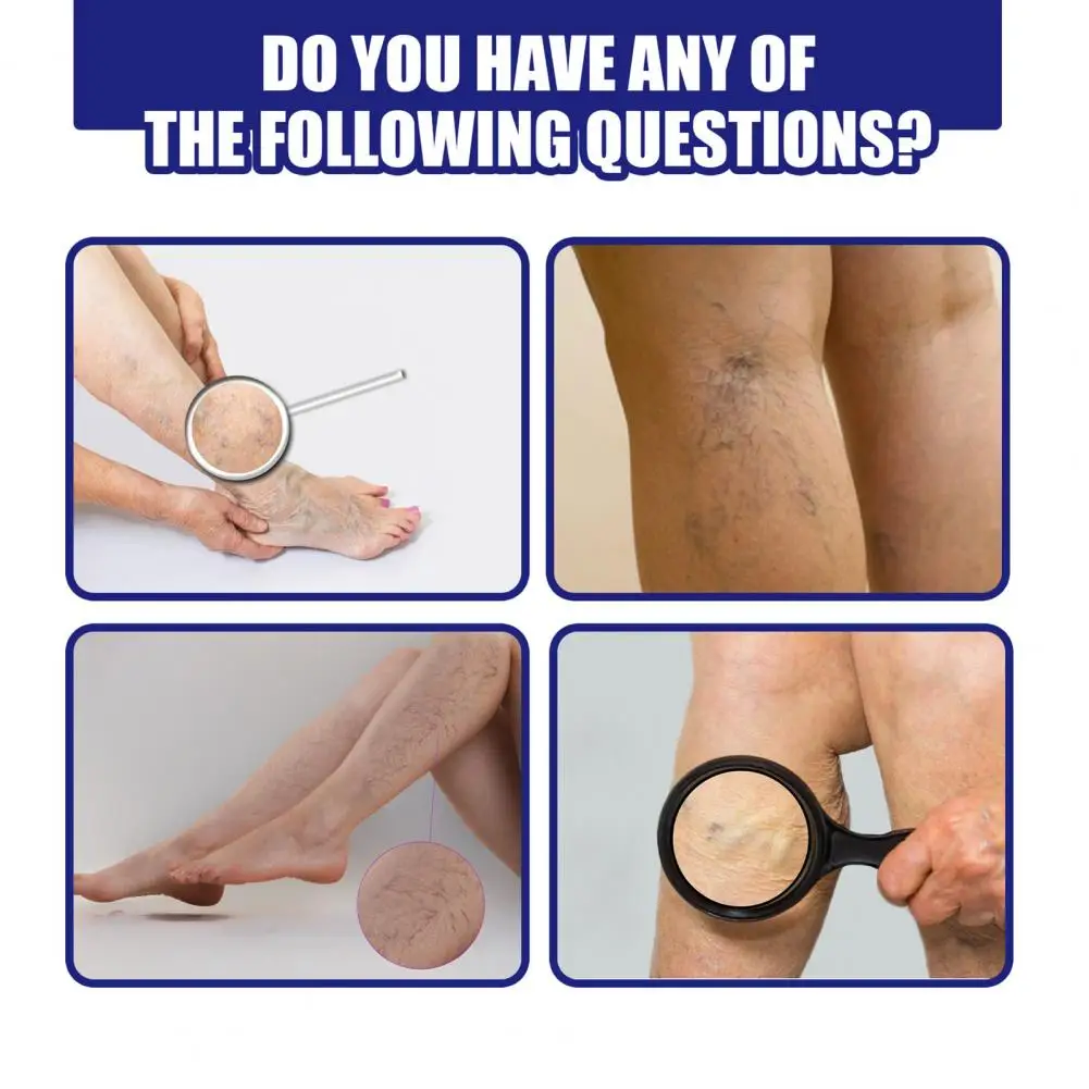 

Improve Circulation Multifunctional Leg Varicose Repair Spray for Unisex