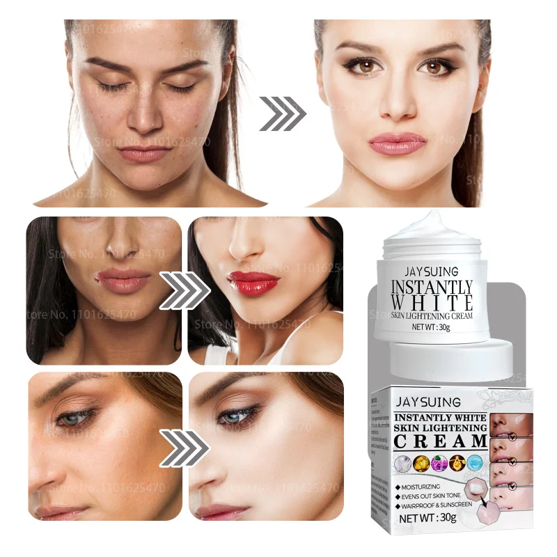 

Whitening Freckle Cream Remove Melasma Acne Spot Pigment Dark Spots Melanin Age Spots Moisturizing Skin Care Liquid Foundation