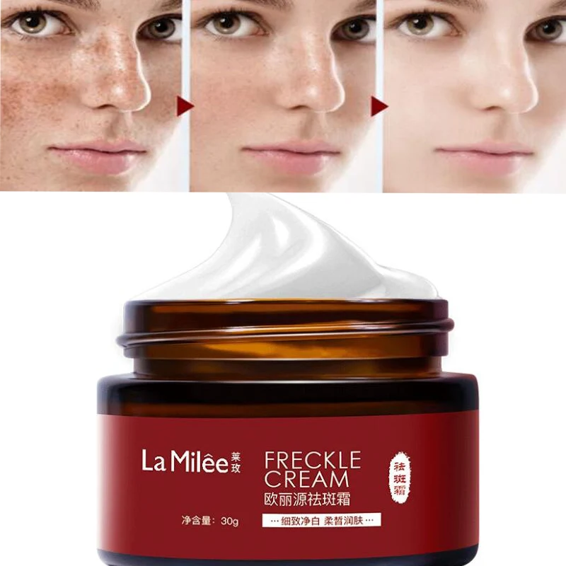 

30g Effective Whitening Freckle Cream Jojoba Oil Remove Dark Spots Witening Cream Fade Acne Scars Anti-Aging Skin Lightening