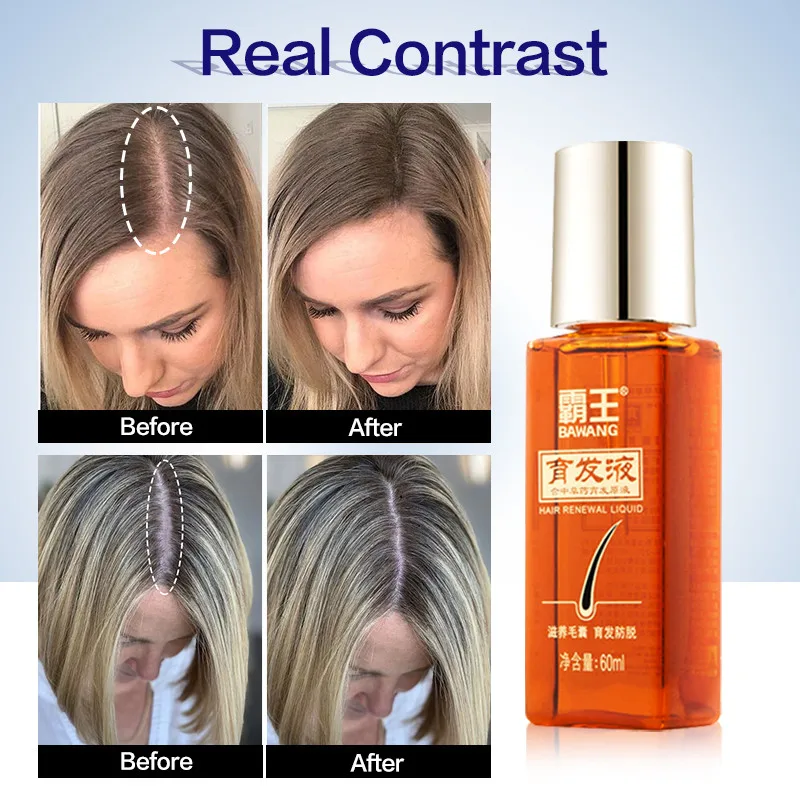 

Hair Care Hair Growth Essential Oils Essence Anti Hair Loss Liquid Health Care Grow Repair Beauty Dense Fast Hair Growth Serum