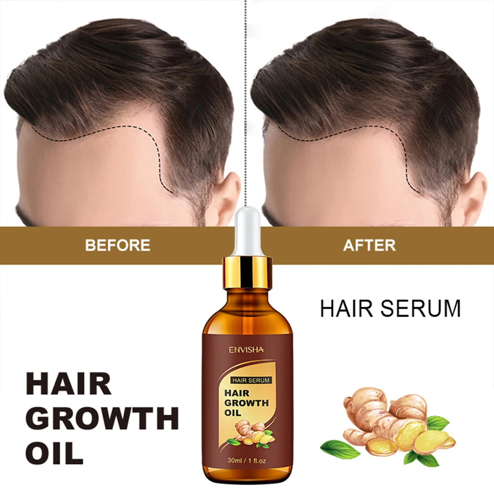 

Натуральное растительное масло для роста волос, 30 мл