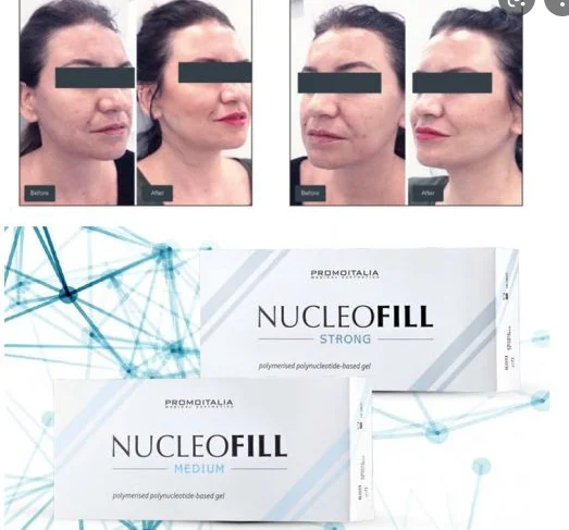 

2022 New Italy NUCLEOFILL STRONG Age Anti-Wrinkle Increase Collagen Production Face Lifting