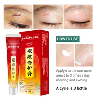 20g acne smoothing whitening moisturizing body skin care acne scar removal cream pimples stretch marks face gel remove