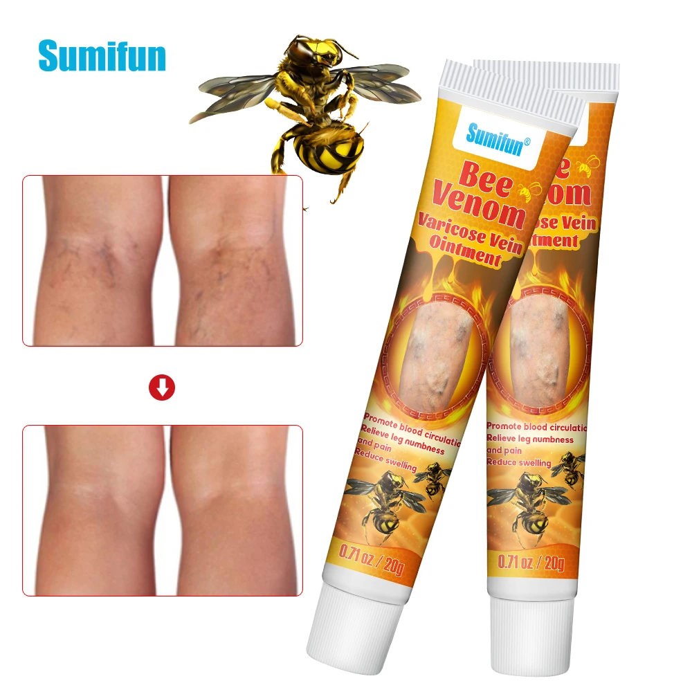 1/3/5/10 шт Sumifun обезболивающий крем от варикозного расширения вен лечение