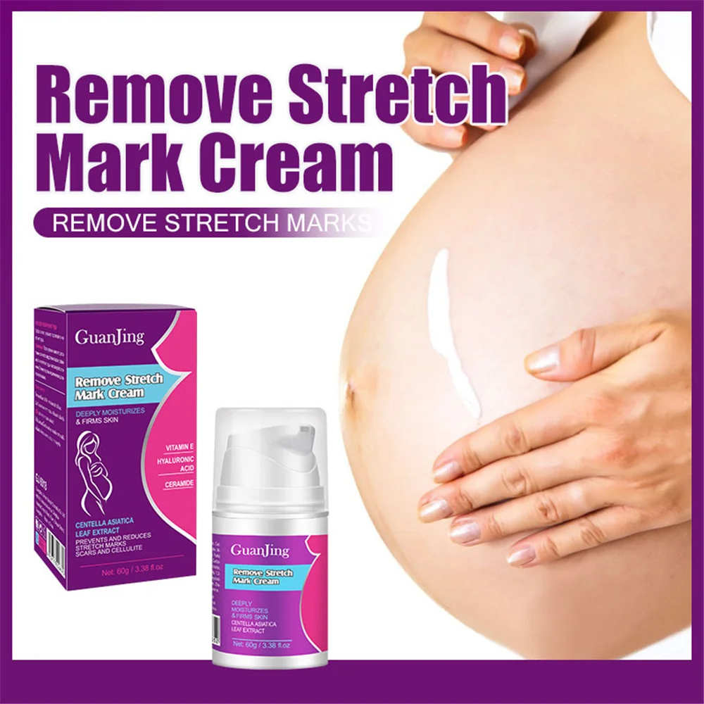 

60g Remove Stretch Marks Cream Maternity Body Care Stretch Marks Removal Scar Treatment Anti-aging Anti-wrinkle Skin Care