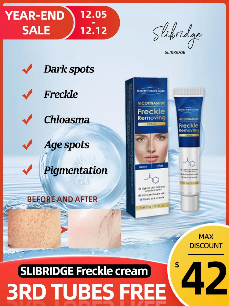 

melasma cream,remover from pigmentation on the face freckle,age spots,Dark spot