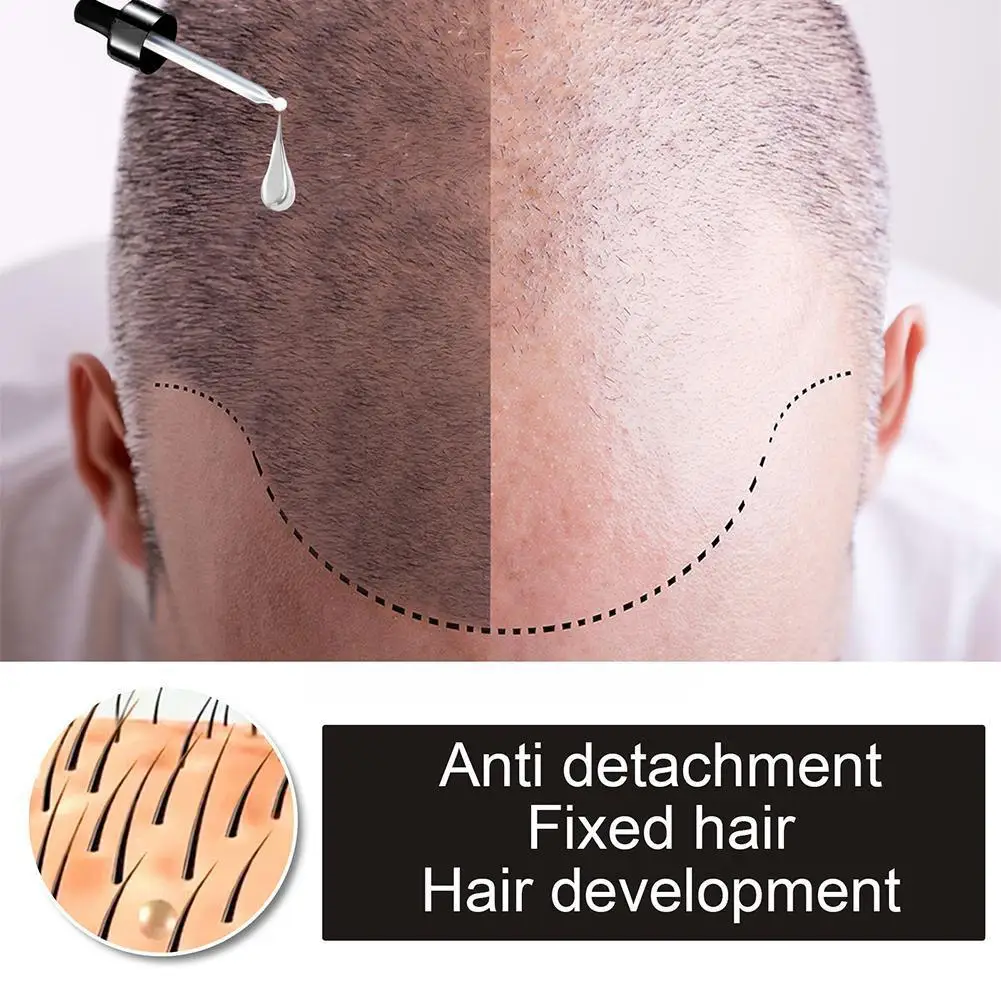 Сыворотка для роста волос эфирное масло против выпадения истончение