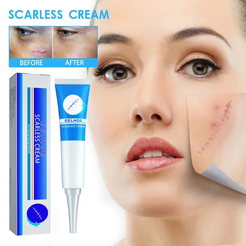 

Scar removal ointment repair skin fade face Acne Spots remove Stretch Marks Treatment surgery Caesarean Section scars cream