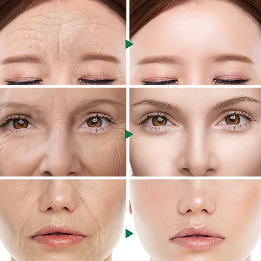 20 шт. капсулы для удаления морщин с гиалуроновой кислотой сыворотка укрепляющая