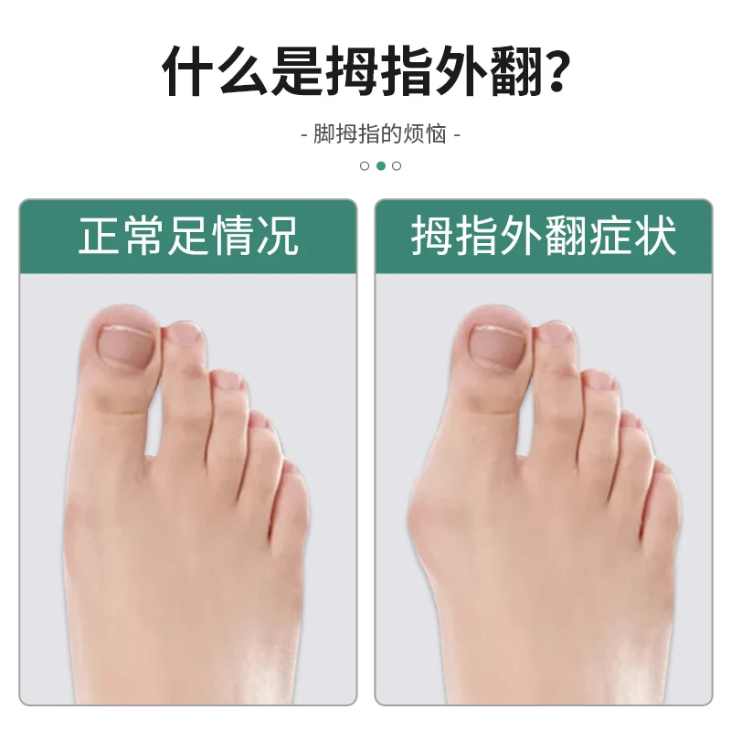 Ортопедическая обувь для мужчин и женщин при вальгусной деформации