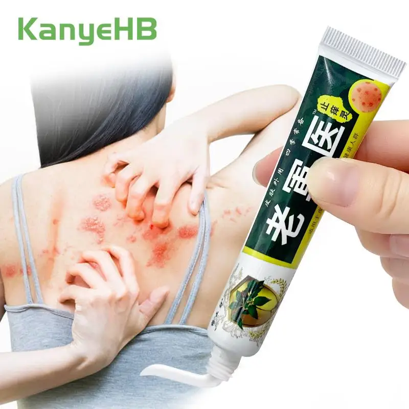 

1Pcs Psoriasis Anti-itch Cream Herbal Medicine Remove Eczema Dermatitis Athlete's Foot Antibacterial Skin Care Ointment S114