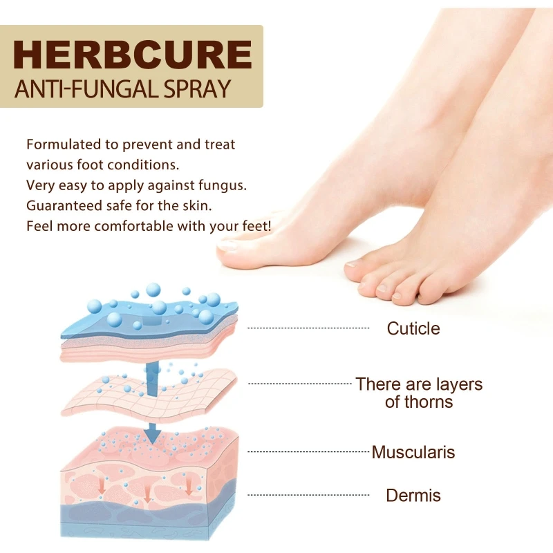 

30ml Herbal Anti Fungal Combat Feet Spray Prevent Itchiness Foot Odor Eliminator