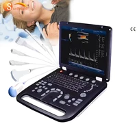cheap price ce approve color doppler ultrasonic diagnostic device portable echography machine dc30 color doppler ultrasound