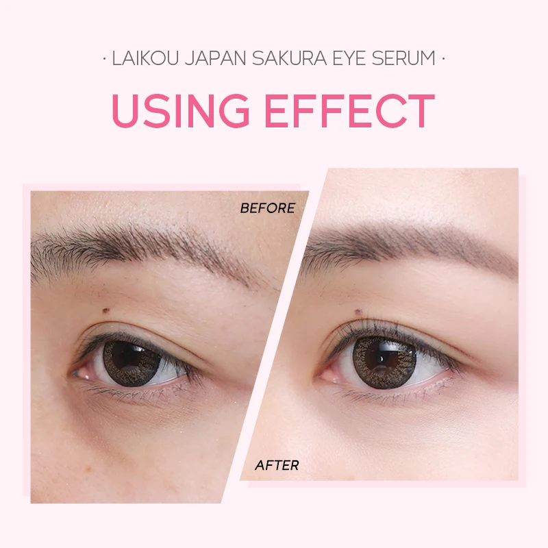 

LAIKOU Sakura Anti-Wrinkle Eye Serum Firm Improve Dullness Fade Dark Circles Remove Eye Bags Puffiness Hydrating Eye Skin Care