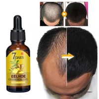 2040ml hair loss products natural ginger plant oil no side effects grow hair faster regrowth hair growth products hair products