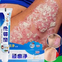 25g psoriasis dermatitis eczematoid eczema ointment anti itch relief dermatitis eczema treatment urticaria skin care cream