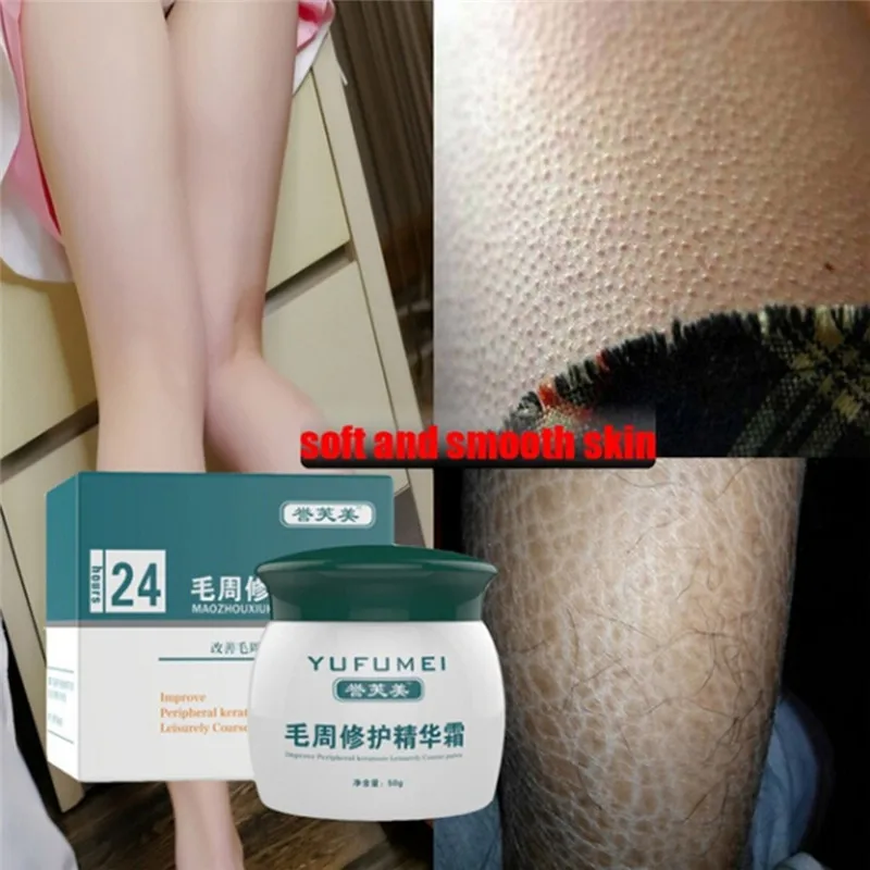 

50g Curing Keratosis Pilaris/ Kp/ Chicken Skin Body Lotion Skin Repair Cream Skin Care Essence Moisturizing And Nourishing
