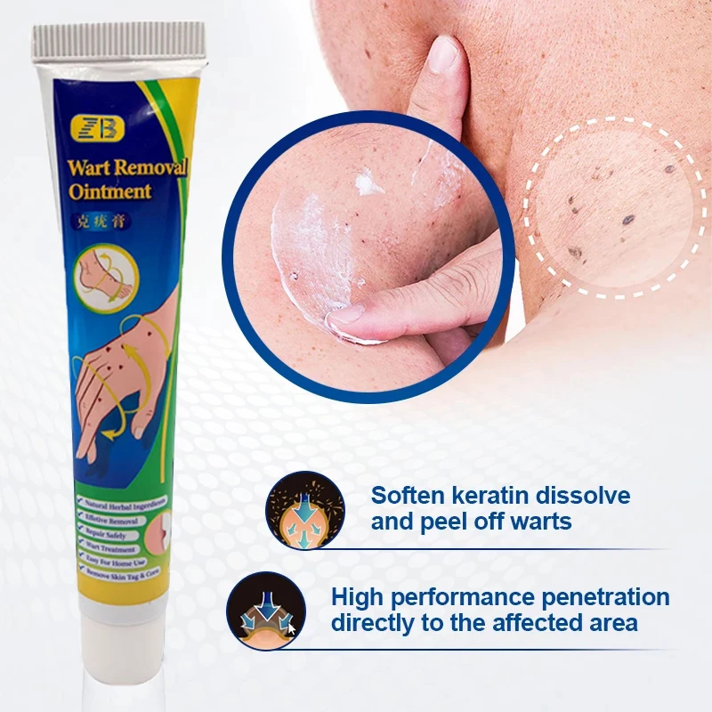 

ZB 1PCS 20g Warts Remover Antibacterial Ointment Wart Treatment Cream Skin Tag Remover Genital Herpes Herbal Treatment Ointment
