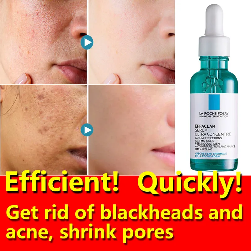 

Triacid Rejuvenating Essence Salicylic Acid Oil Control Removes Blackheads Acne Reduces Acne Marks Shrinks Pores Smoothes Skin