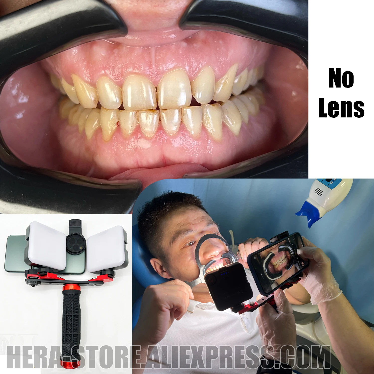 Najtaniej Pełne Stomatologiczne Ustne Wypełnienie światło Wewnątrzustny Sprzęt Fotograficzny Stomatologia Latarka Dla Dentystów Fotografia Makro