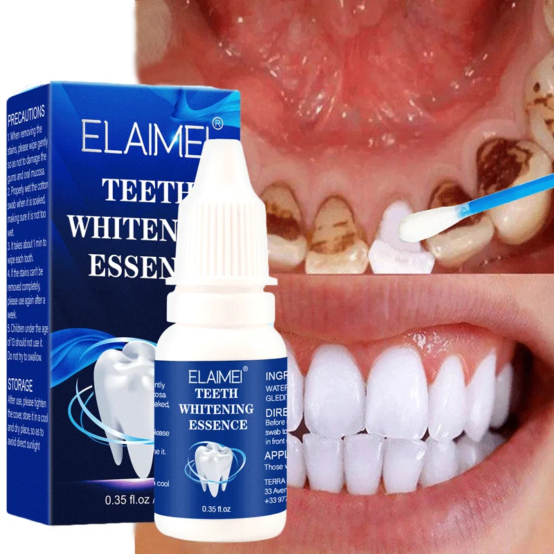 Teeth Whitening Essence Fast Remove Plaque Stains Whiten Teeth  Remove Oral Odor Fresh Breath Oral Hygiene Dental Bleach Tool