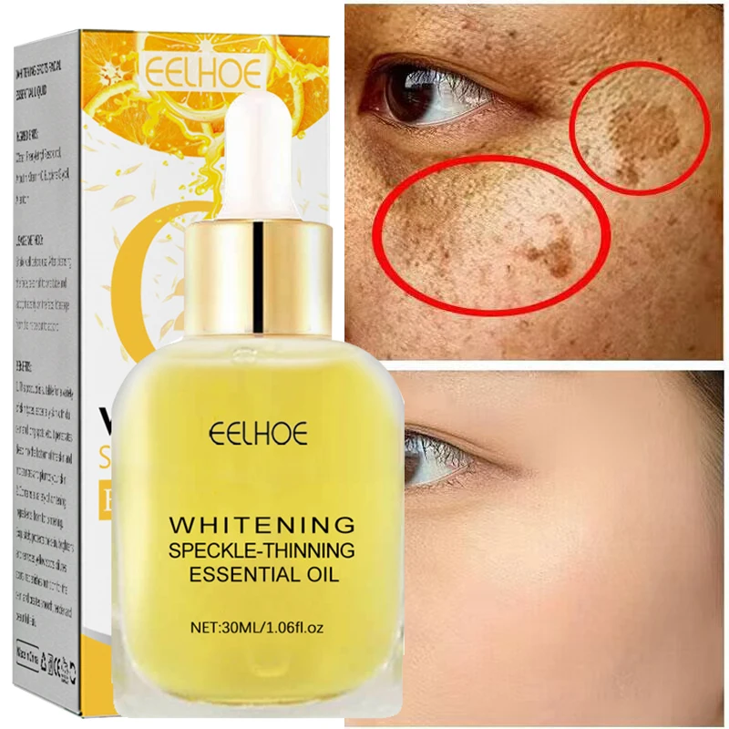 

Effective Whitening Freckle Essence Products Vitamin C Remove Dark Spots Face Serum Fade Pigmentation Melasma Brighten Skin Care