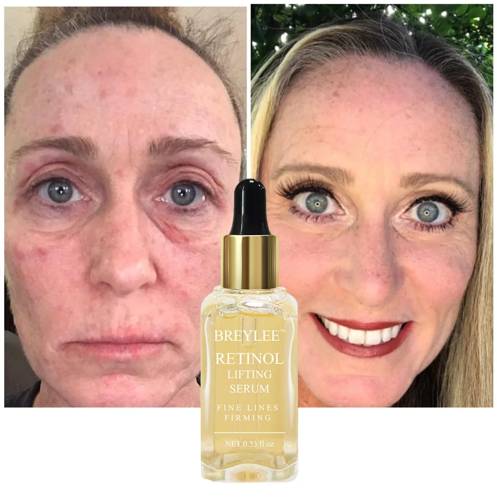 

Anti-Aging Retinol Remove Wrinkles Serum Collagen Lifting Firming Face Essence Skin Care Fade Fine Lines Repair Smooth Serum