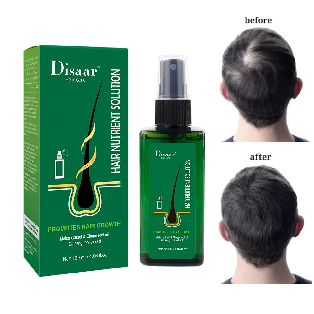 

120ml Neo Hair Lotion Serum Essence Original Hair Growth Oil Anti-loss Treatment Hair Beard Growth 100% Natural Herbs Spray Kit