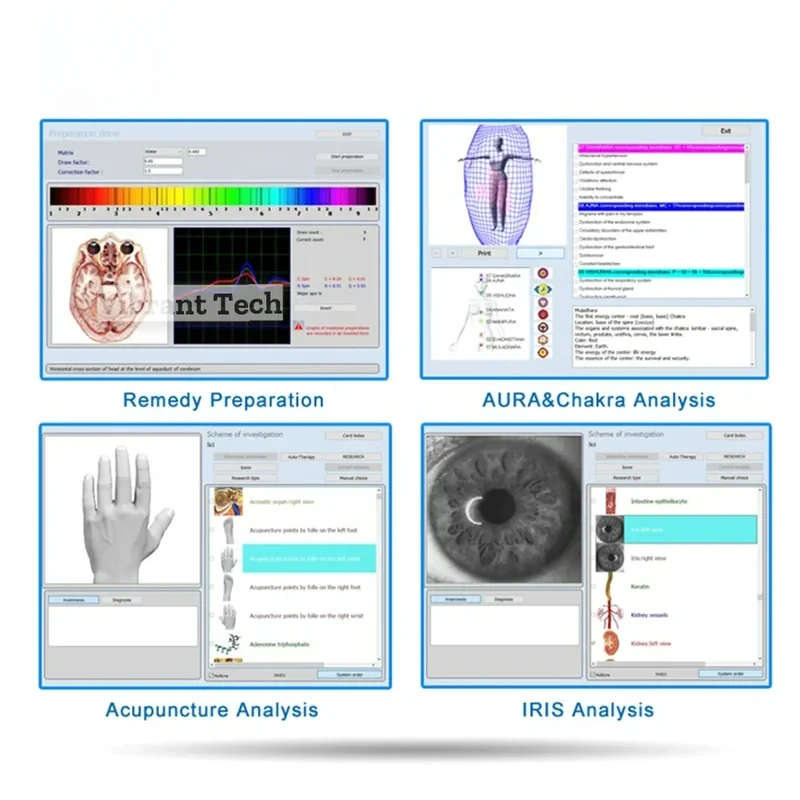 Оригинальный русский 3D-анализатор Bioplasm Nls Pro для машины Aura и Chakra