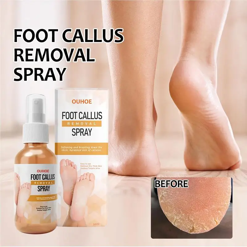 

Foot Callus Remover Spray 1.01 Oz Quickly Soften Calluses Exfoliation Dry Feet Skin Hydrating Foot Dead Skin Spray Foot Care