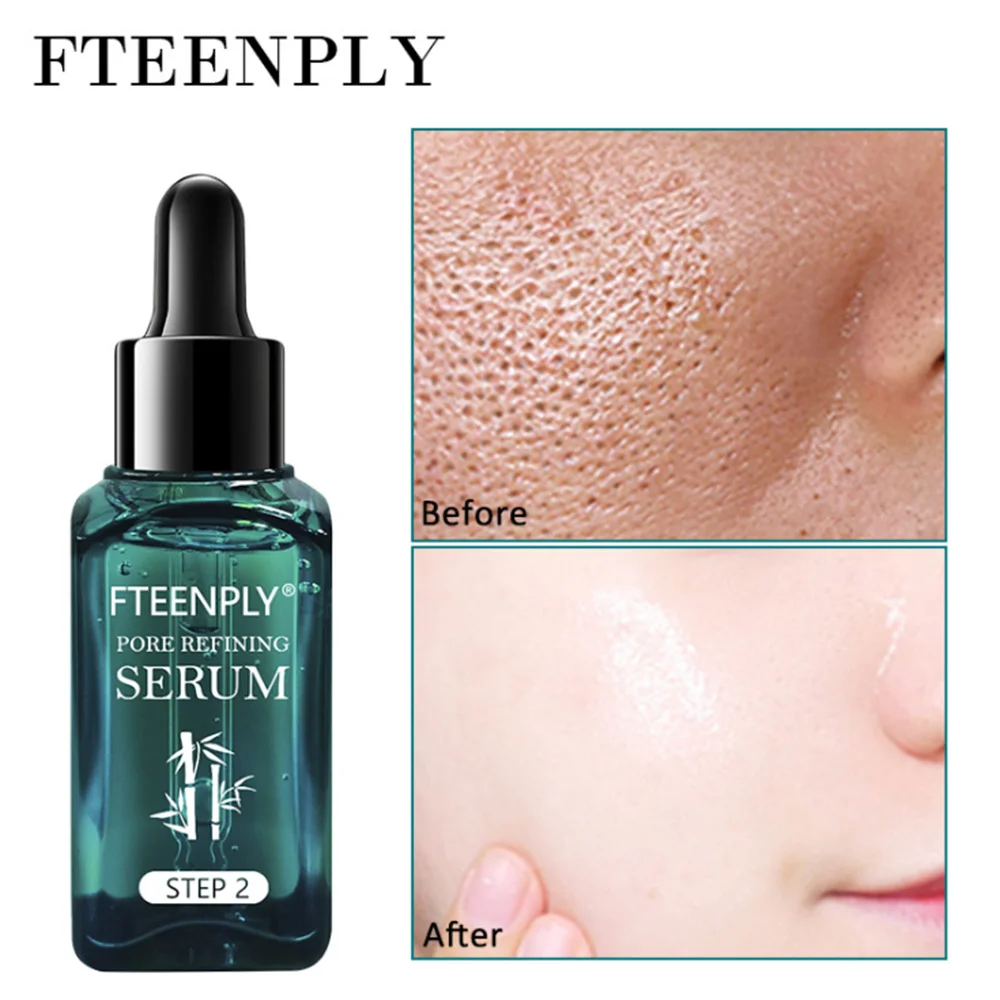 

FTEENPLY Shrink Pores Serum Remove Tea Tree Blackheads Hyaluronic Acid Moisturizing Nourishing Deep Cleaning Oil Control Firm