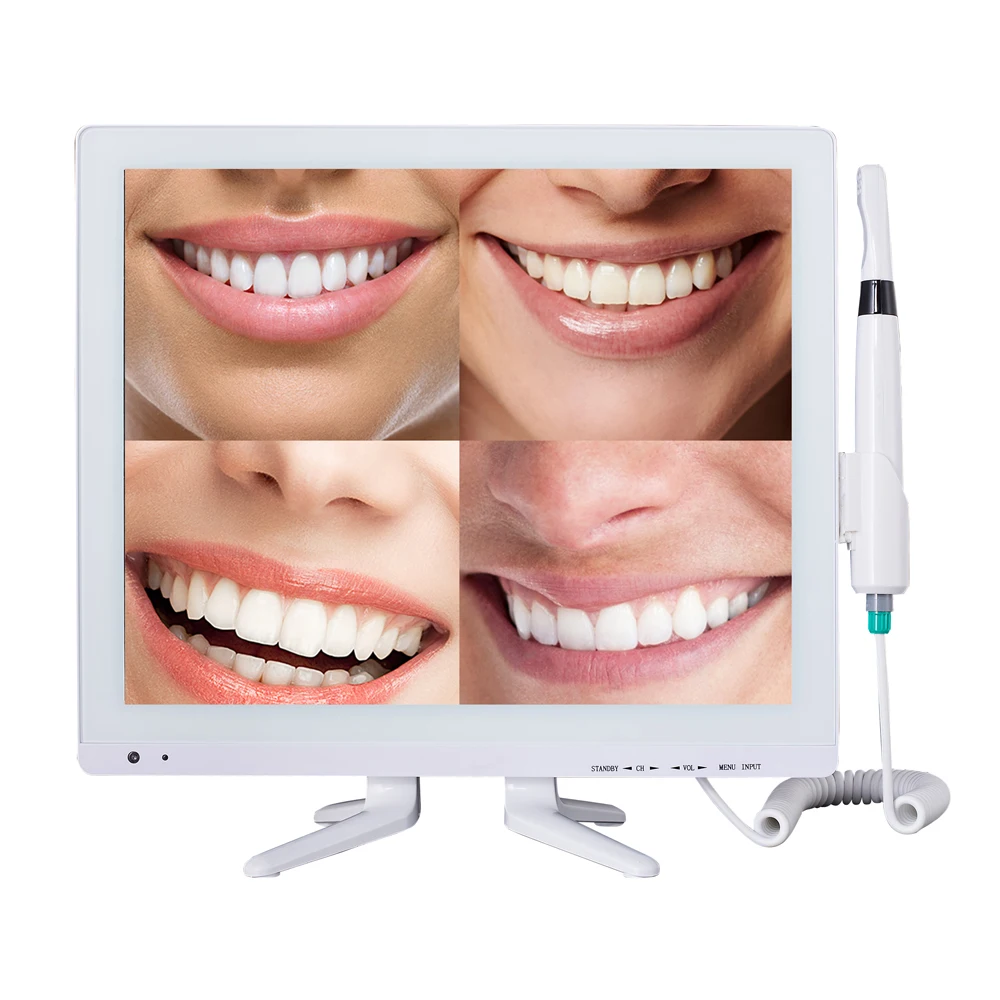 

AliGan Dental Equipment Medical new model hd 17 inch screen 1280*1024 Pixel High Resolution wifi usb Endoscope intraoral camera